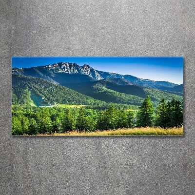 Print on acrylic Hill in the Tatra Mountains